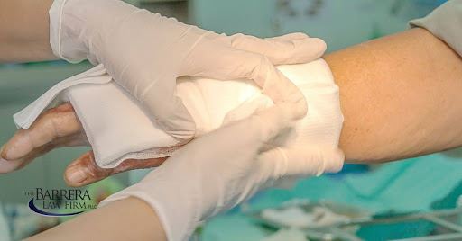 person with burn on hand